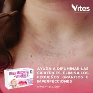 ROSA MOSQUETA MAS VITAMINA E - Imagen 3
