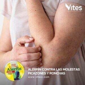 ALERFÍN CREMA - Imagen 3