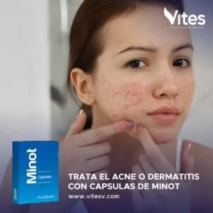 MINOT 100MG 10 Comprimidos - Imagen 3